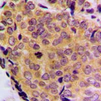 Polyclonal Rabbit anti-Human BCL2L2 / Bcl-w Antibody (C-Terminus, IHC, IF, WB)