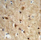 Polyclonal Rabbit anti-Human NEURL1 / NEURL Antibody (aa158-186, IHC, WB)