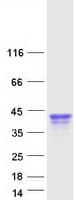Human ORM1 / Orosomucoid Protein (Recombinant Myc-DDK (Flag))