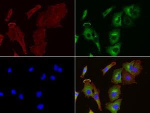 Monoclonal Mouse anti-Human SQSTM1 Antibody (clone UMAB12, Carrier-free, IHC, IF, WB)