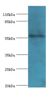 RBMY1F Antibody (aa1-496)