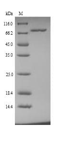 Human CLINT1 Protein (Recombinant 6His, N-terminus)