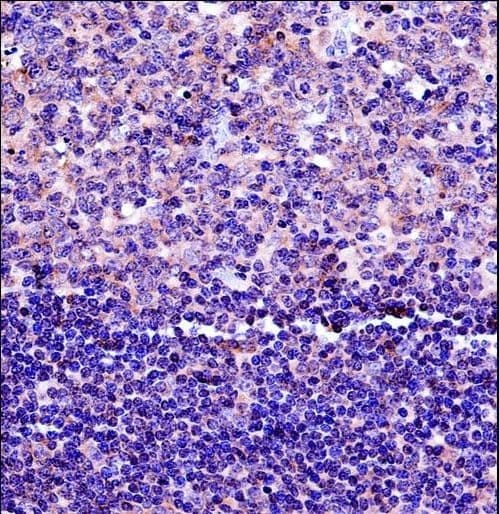 HLA-DPB1 Antibody (aa77-105)