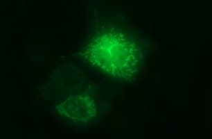 IHC-plus™ ARG2 / Arginase 2 Antibody (clone 3G5)