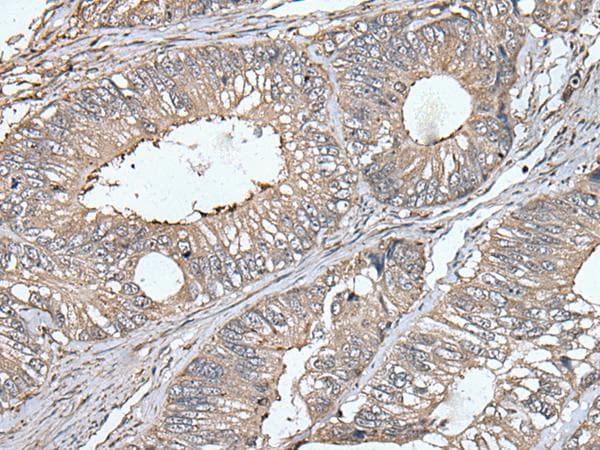 UNC13B Antibody