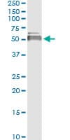 IHC-plus™ LIPA / Lysosomal Acid Lipase Antibody (clone 1F9)