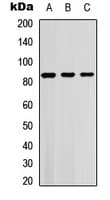 SGK1 / SGK Antibody (phospho-Thr256/253)