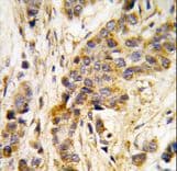 Polyclonal Rabbit anti-Human IARS2 Antibody (aa600-628, IHC, WB)
