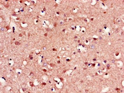 Polyclonal Rabbit anti-Human FZD8 / Frizzled 8 Antibody (IHC, WB)