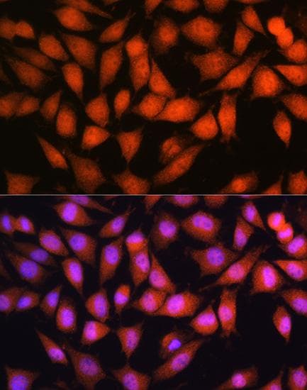 OTUB1 / OTU1 Antibody