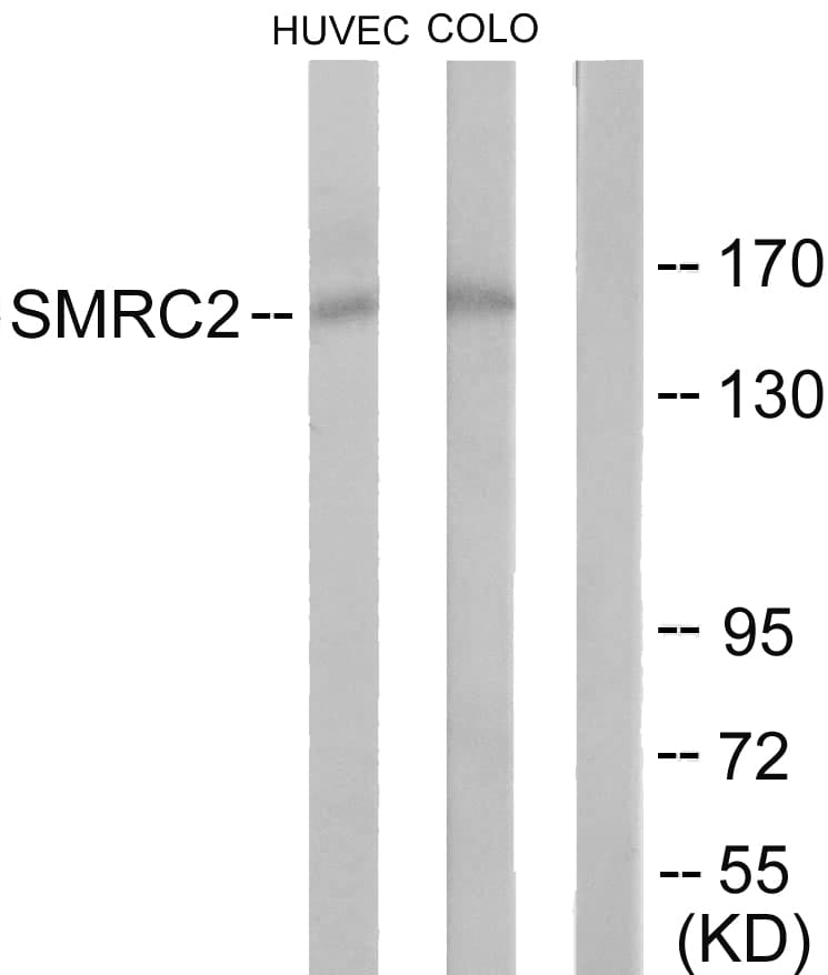 SMARCC2 Antibody (aa361-410)