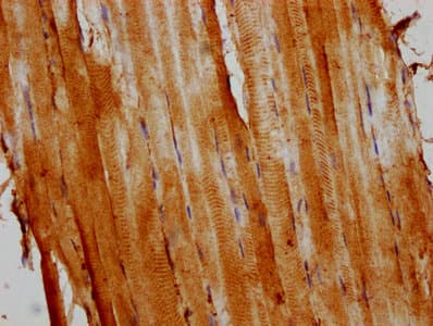 ACTA1 / Skeletal Muscle Actin Antibody