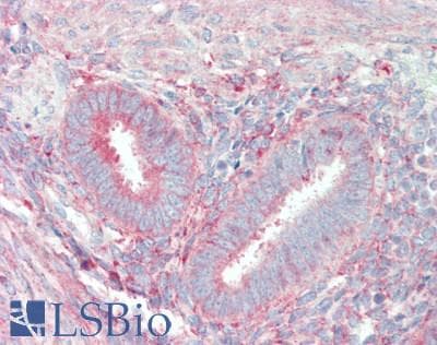 IHC-plus™ Polyclonal Rabbit anti-Human AMPD2 Antibody (IHC, IF)