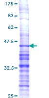 Human PDYN / ProDynorphin Protein (Recombinant GST, N-terminus)