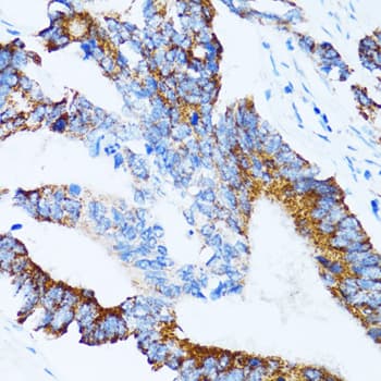 Polyclonal Rabbit anti-Human CLDN11 / Claudin 11 Antibody (IHC, IF, WB)