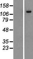 DENND2A / KIAA1277 Protein (Over-Expression Lysate Myc-DDK (Flag))