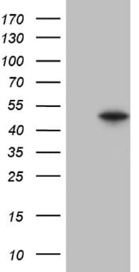 GNAS Antibody (clone OTI7A6)