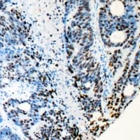 RB1 / Retinoblastoma / RB Antibody (Internal)