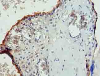 PGS1 Antibody