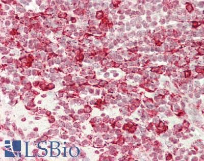 IHC-plus™ Monoclonal Mouse anti-Human HAX-1 Antibody (clone 9G6C6, IHC, WB)