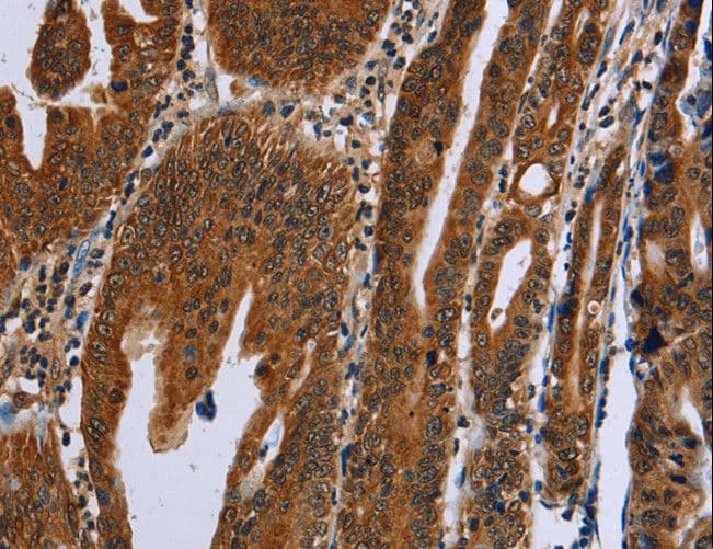 GH2 Antibody