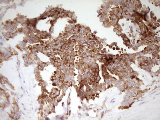 FARSB Antibody (clone OTI4B3)