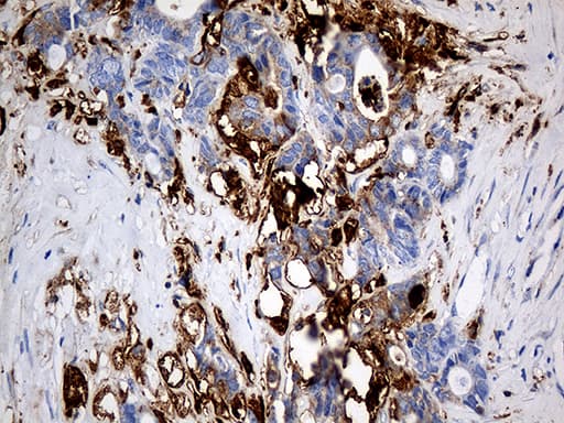 PTPN22 / PEP Antibody (aa359-449, clone OTI6B1)