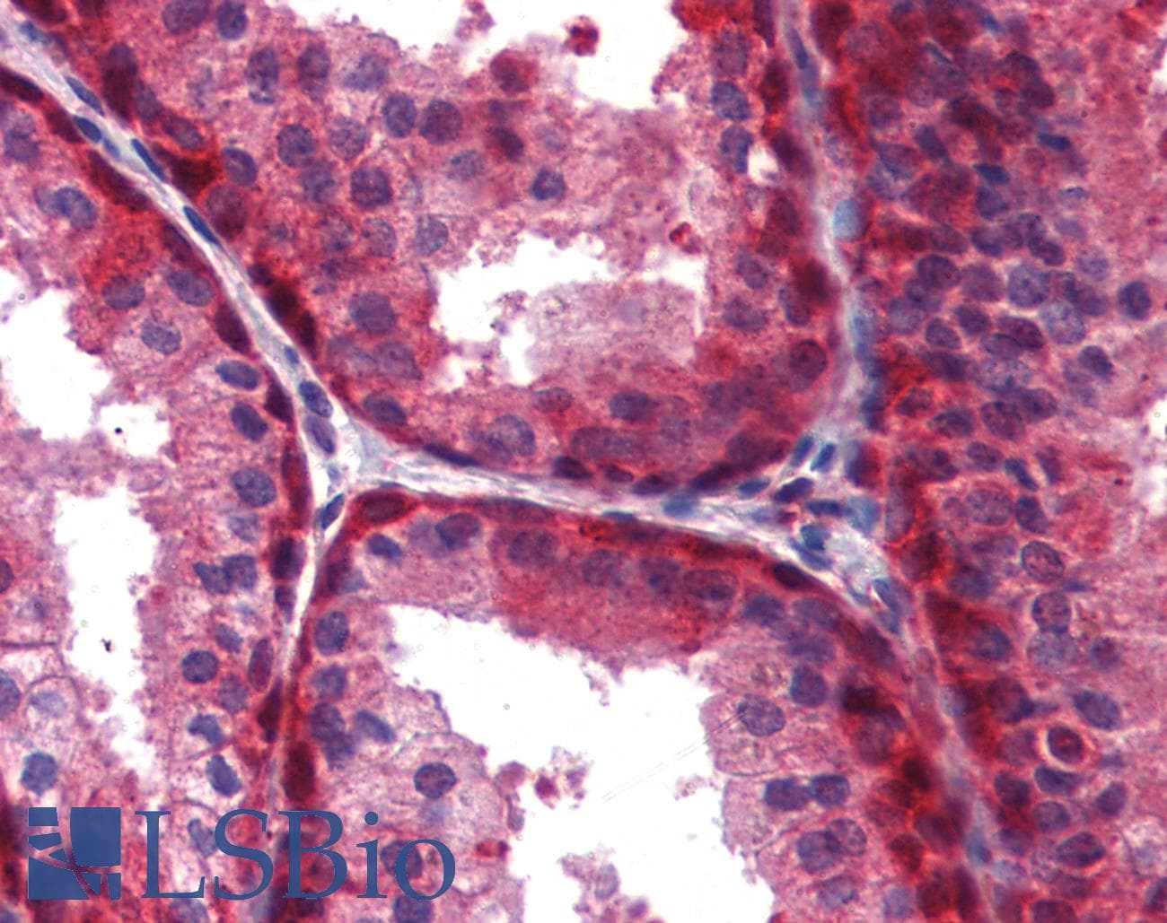 IHC-plus™ Monoclonal Mouse anti-Human WNT5A Antibody (clone 3D10, IHC, WB)