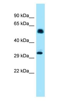 IP6K1 Antibody (aa94-143)