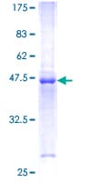 Human IL20 Protein (Recombinant GST)