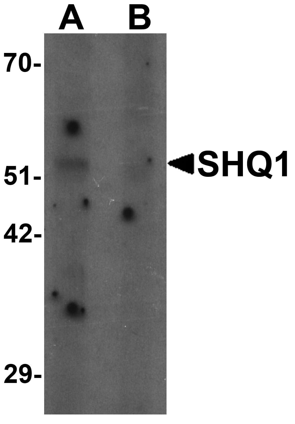 IHC-plus™ Polyclonal Rabbit anti-Human SHQ1 Antibody (IHC, IF, WB)