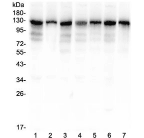 Polyclonal Rabbit anti-Human ANO1 / DOG1 / TMEM16A Antibody (WB)