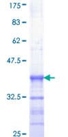 Human ELK1 Protein (Recombinant GST, N-terminus)