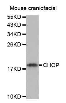 IHC-plus™ Polyclonal Rabbit anti-Human DDIT3 / CHOP Antibody (IHC, IF, WB)