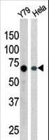 RAD9A / RAD9 Antibody (phospho-Ser387)