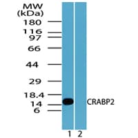 CRABP2 Antibody (aa75-125)