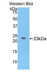 IL17RB Antibody (aa310-499)