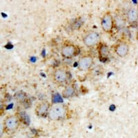 HARS2 Antibody
