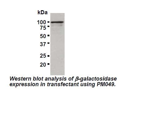 Polyclonal Rabbit GLB1 / Beta-Galactosidase Antibody (IHC, WB)