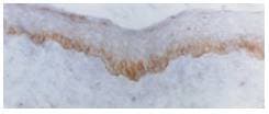ITGB4 / Integrin Beta 4 Antibody (aa1809-1822)