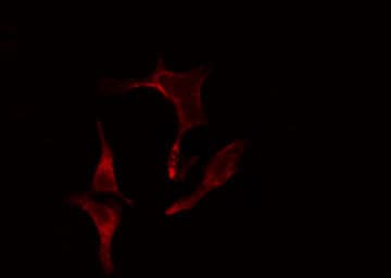 Polyclonal Rabbit anti-Human EIF2B4 Antibody (IF, WB)