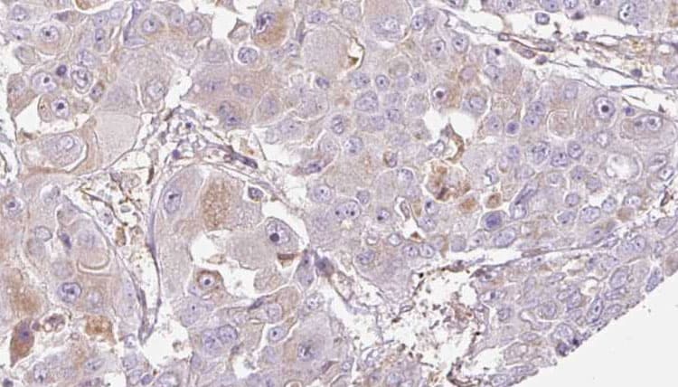 OR52J3 Antibody