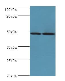 AP1M2 Antibody (aa164-423)