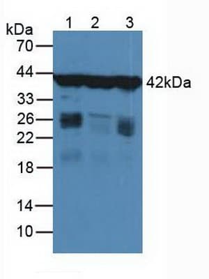 ACTG1 / Gamma Actin Antibody (aa1-375)