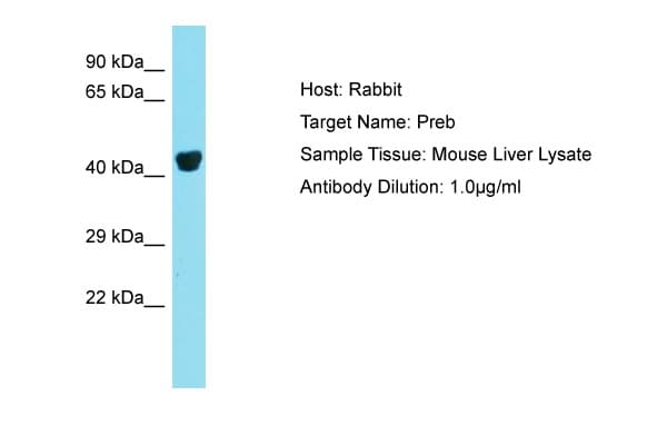 PREB Antibody (N-Terminus)