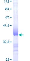 Human DGUOK / Deoxyguanosine Kinase Protein (Recombinant GST, N-terminus)