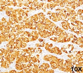 MLANA / Melan-A Antibody (clone M2-7C10, Azide-free, BSA-free)