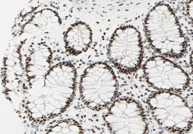 Polyclonal Rabbit anti-Human RAF1 / RAF Antibody (phospho-Ser259, IHC, IF, WB)
