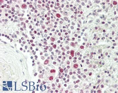 IHC-plus™ NR3C1/Glucocorticoid Receptor Antibody (aa171-220)