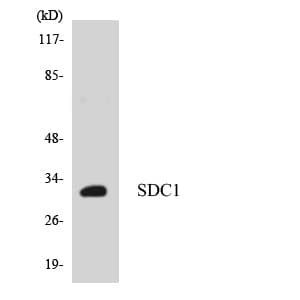 Polyclonal Rabbit anti-Human SDC1 / Syndecan 1 / CD138 Antibody (aa83-132, WB)